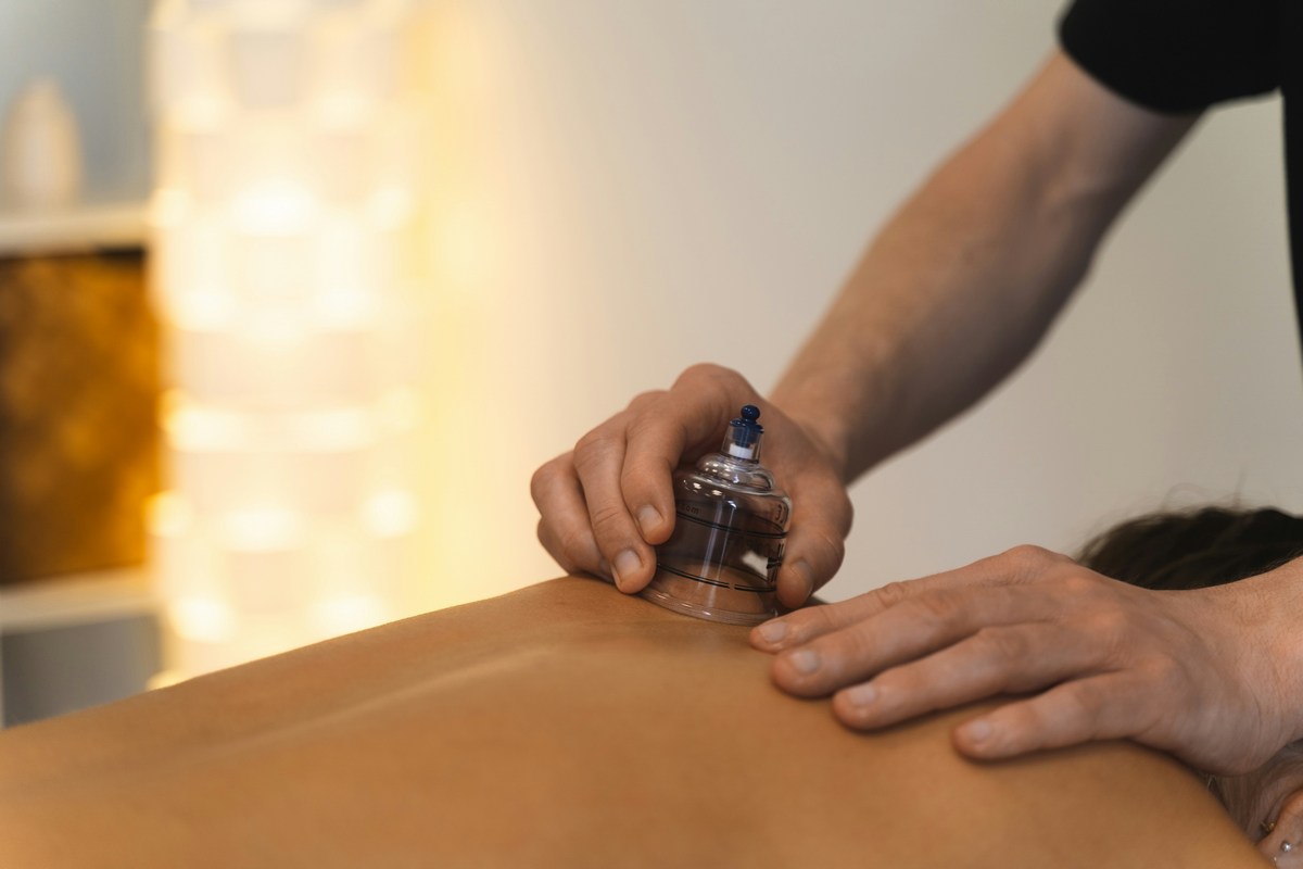 Myofascial Cupping